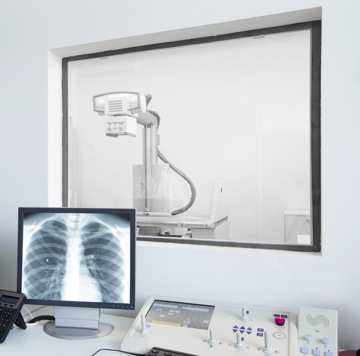 Stuburo rentgenograma - pagrindinis osteochondrozės diagnozavimo metodas