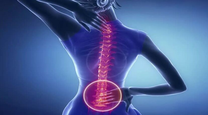 Stuburo osteochondrozė