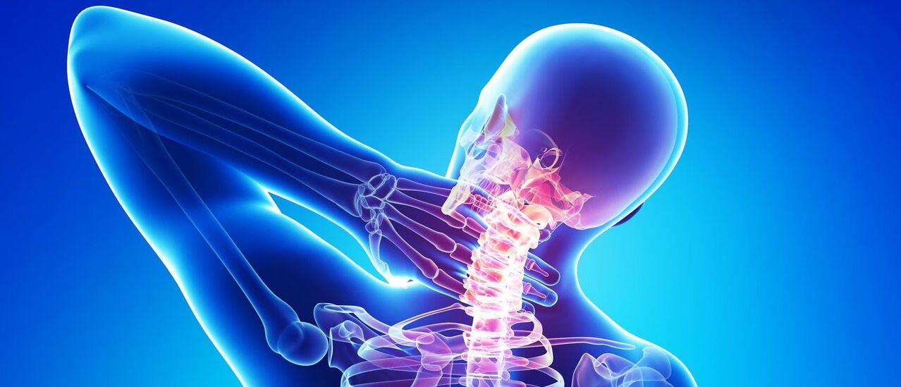 Gimdos kaklelio osteochondrozė yra patologinis stuburo srities procesas