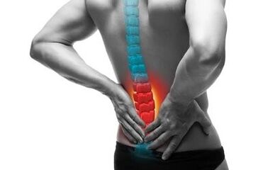 Osteochondrozė yra stuburo liga