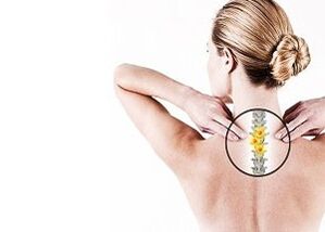 krūtinės ląstos stuburo osteochondrozė
