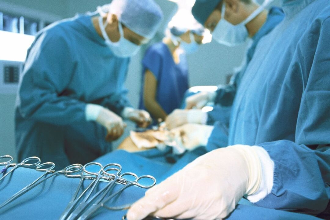 Osteochondrozės chirurginis gydymas