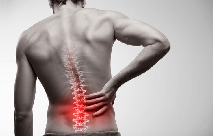 apatinės nugaros dalies skausmas dėl osteochondrozės